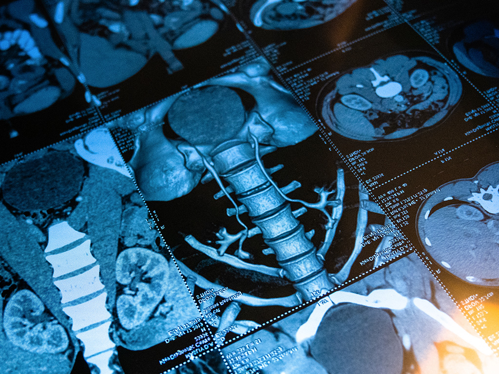Medical imaging showing internal injuries and trauma following a motor vehicle collision.
